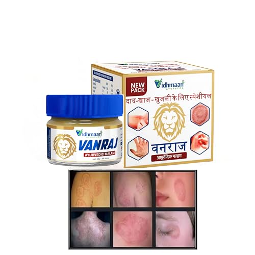 Image of Ayurveda Vanraj fungal Malam Ointment - for Ringworm, itching, & Skin Infection, Skin Tretment, Skin Care (PACK OF 1)
