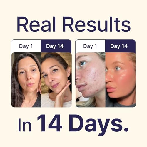 Tallow and Manuka Honey Balm, 2 oz, Unscented, Grass Fed Grass Finished, Face Cream, Body, Lotion, and Lip Balm