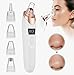 Pore Vacuum - Blackhead Remover Vacuum & Suction Tool for Face - Efficient Pore Sucker Blackhead Vacuum Cleaner - Electric Blackhead Suction Remover, Facial Pore Extractor for Clear Skin