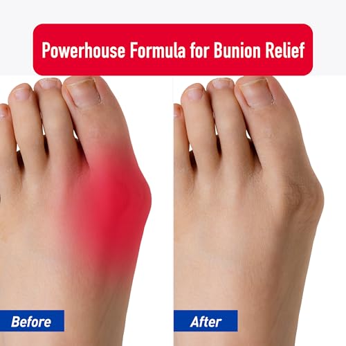 PROFOOT Bunion Relief Rub, White