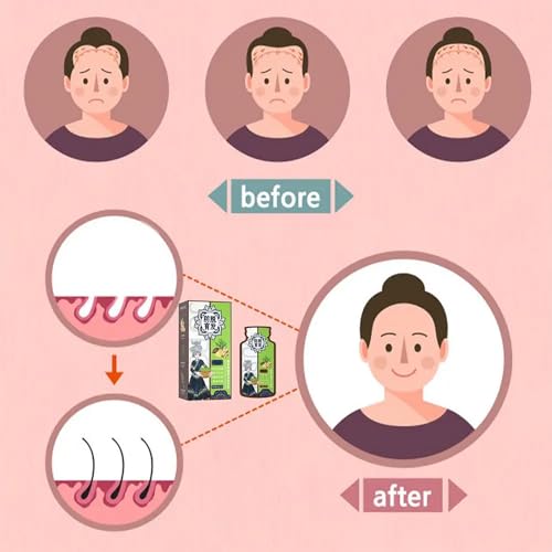 Ginger Anti Hair Loss Shampoo,Haarwachstum Shampoo,Polygonum Multiflorum Ginger Plant Extract Hair Care,Pflanzenextrakt ShampooGegen Haarausfall, Natürlich Bio Anti-Haarausfall