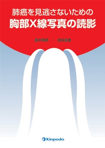 無料電子書籍 pdf 肺癌を見逃さないための胸部X線写真の読影 バイ