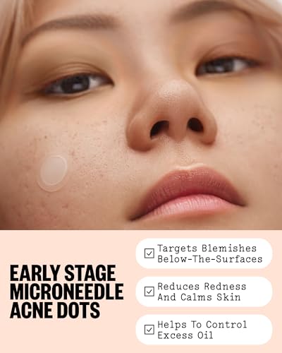 PEACE OUT Early Stage Acne Dots — view 3