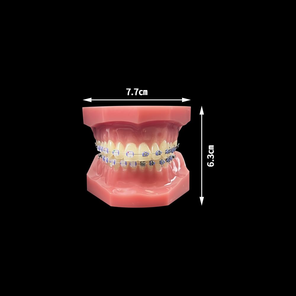 Orthodontisches Zahnmodell mit Halterungen, YOUYA DENTAL Demonstration Orthodontisches Modell für Bildung, Zähne Demonstration Typodonte Anatomisches Lehrwerkzeug mit Metall und Keramischer Halterung