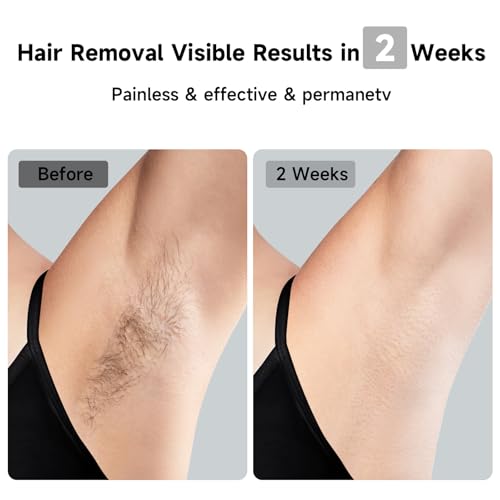 Image of JOVS Laser Hair Removal, 37F Painless Hair Removal Device with Sapphire Ice-Cooling, 3 in 1 Hair Removal & Skin Rejuvenation for Women and Men, 8 Modes Skin Care for Whole Body, Touch Screen, White