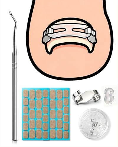 BEZOX Ingrown Toenail Corrector Kit Professional Ingrown Toenail Tools Kit with Traction Hooks Bands & Adhesive Patches Pain-Free Ingrown Toenail Correction & Toenail Lifter Treatment Tool