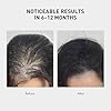 0.9% KX-826 KINTOR Hair Growth Spray,Strengthen Hair Nourish Hair follicles,Hair Care Products for Sparse Hair and Oily Hair Men&Women,60ml,Pro