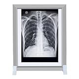 Röntgen-Betrachter mit einstellbarer Helligkeit, professioneller TPC-Objektträger-Betrachter mit Halterung und optischem Acryl-Diffusor für den Heim- und Laborgebrauch(40x50cm/16x20in)