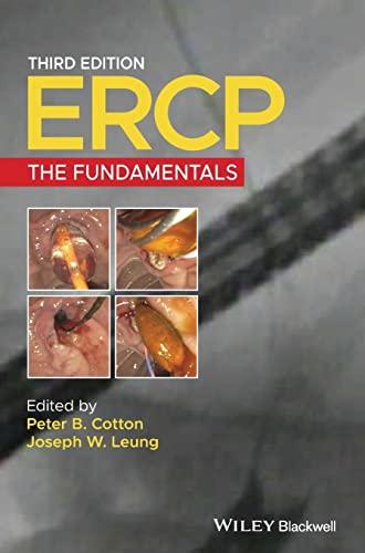 Ercp view 2