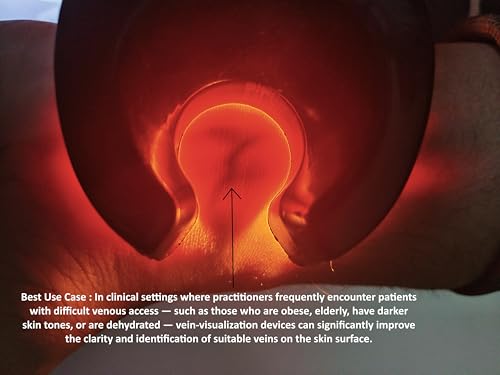 Image of Portable Infrared Vein detector for Adults and Children | Accurate Vein Detection for Medical Use