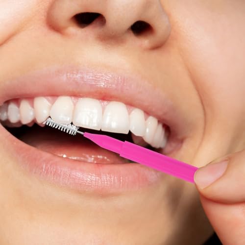 Image of Healeved 100PCS Braces Brushes Interdental Brushes Braces Flossers Braces Brush for Cleaner Toothpick Dental Flossing Head Oral Flosser Dental Picks for Teeth Cleaning(10 Colors)