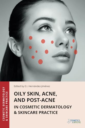 Oily Skin, Acne, and Post-Acne in Cosmetic Dermatology & Skincare Practice