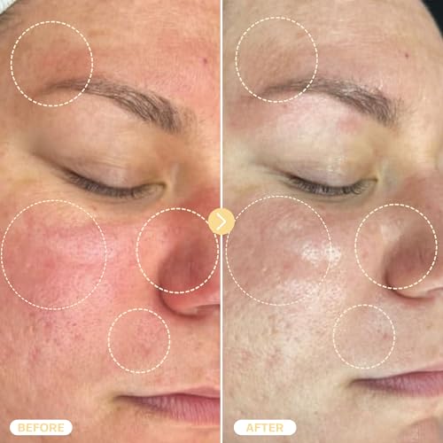 BASE LABORATORIES Hypochlorous Acid Spray for Face & Skin - Travel Size - Facial Toner Spray & Cleaner - Skin Repair Solution helps reduce redness, Irritations, acne - HOCL Molecule Spray 2oz