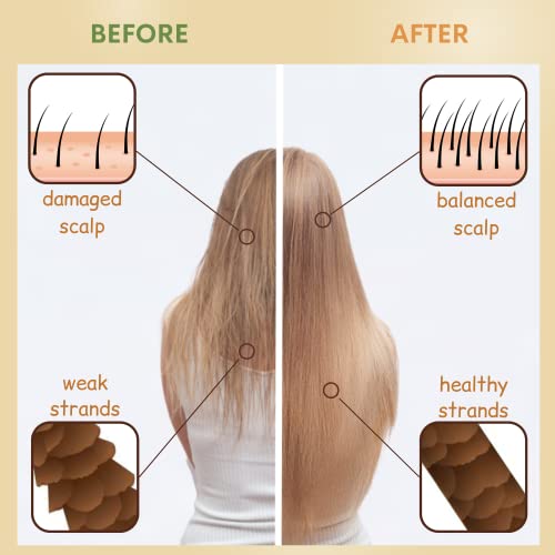 Muun Rice Water Shampoo And Conditioner Set For Hair Growth, Regrowth, Thinning Hair And Anti Hair Loss, Fall With Natural Ingredients Including Biotin, Keratin And Caffeine, Men And Women. #TOP3