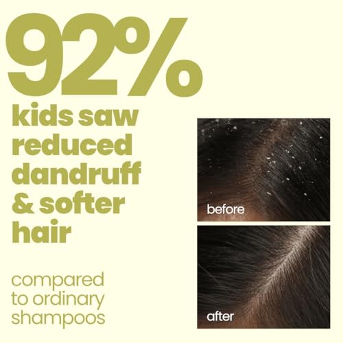 TuCo Kids Anti-Dandruff Shampoo With Wintergreen, Mint & Activated Charcoal | For Itchy Scalp & Rough Hair |Ph5.5, Vegan & Tear Free | Ages 2-5, 4-10, 10-15 Years | 200Ml