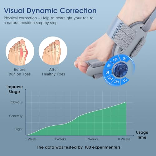 Image of KASHEVI Bunion Corrector for Women & Men Big Toe: Adjustable Bunion Fix for Big Toe Separation Pain Relief - Orthopedic Bunion Splint with Straightener for Toes Alignment Hallux Valgus Correction