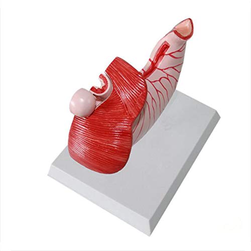 Modelo Anatômico de Estômago Humano Mudanças Patológicas Anatomia para Sala de Aula Estudo Modelo Mé