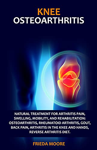 KNEE OSTEOARTHRITIS: Natural Treatment for Arthritis Pain, Swelling, Mobility, and Rehabilitation: Osteoarthritis, Rheumatoid Arthritis, Gout, Back Pain, Reverse Arthritis Diet.