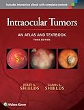 Intraocular Tumors: An Atlas and Textbook (Volume 1)