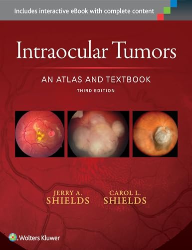Intraocular Tumors: An Atlas and Textbook (Volume 1)