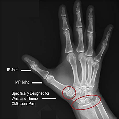 Comfort Cool Thumb CMC Restriction Splint, Right Small 6" to 7" - Thumbnail 6