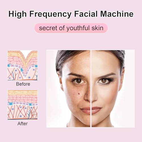 Yofuly High F-requency Face Wand with 4 Violet Beauty Stabs, Portable High F-requency Facial Machine - Image 4