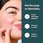 Mighty-Patch-Micropoint-for-Blemishes-from-Hero-Cosmetics-Hydrocolloid-Acne-Spot-Treatment-Patch-for-Early-Stage-Zits-and-Hidden-Pimples-395-Proprietary-Micropoints-8-Patches