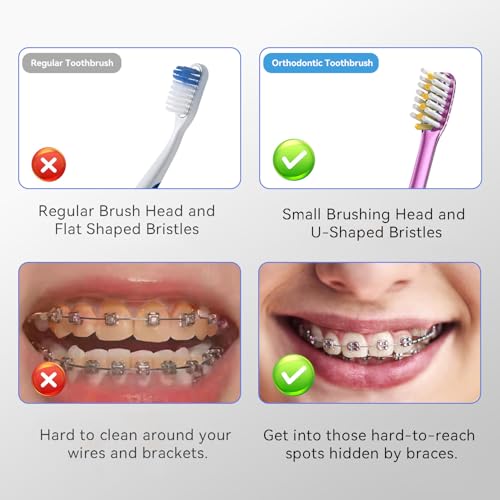JTF Orthodontic Manual Toothbrush for Braces: 6 U-Shaped Tooth Brush with 6 Interdental Brushes, Ultra-Durable Bristles for Stain Removal and Deep Oral Clean, Toothbrushes for Tooth with Dental Device - Image 6