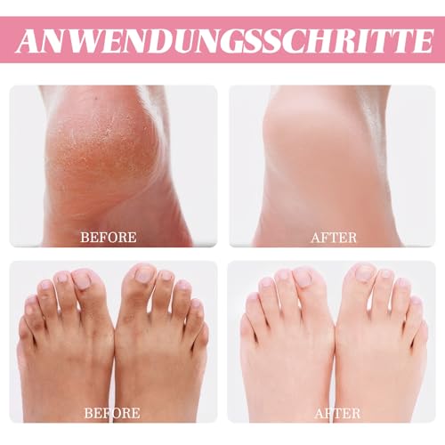 Fusspflege Creme 2 Stück Anti-Cracking Fußcreme Feuchtigkeitsspendend und Risshemmend Foot Cream Stick, Urea Repair Plus Fußcreme Zur Linderung Extrem Trockener und Rissiger Füße – Bild 4