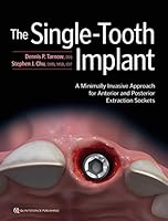The Single-Tooth Implant: A Minimally Invasive Approach for Anterior and Posterior Extraction Sockets 0867157712 Book Cover
