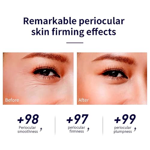 Easilydays Snail Peptide Advanced Under Eye Cream For Dark Circles thumb #3