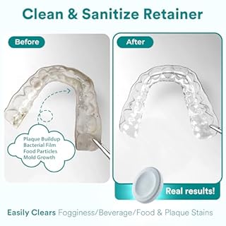 Weiss Naturals Retainer Cleaner Tablets, Invisalign Cleaner, Remove Stains, Odors & Plaque, PERSULFATE FREE Night Guard & Denture Cleaner 1-Month Supply, 30 Mint Scented Tablets
