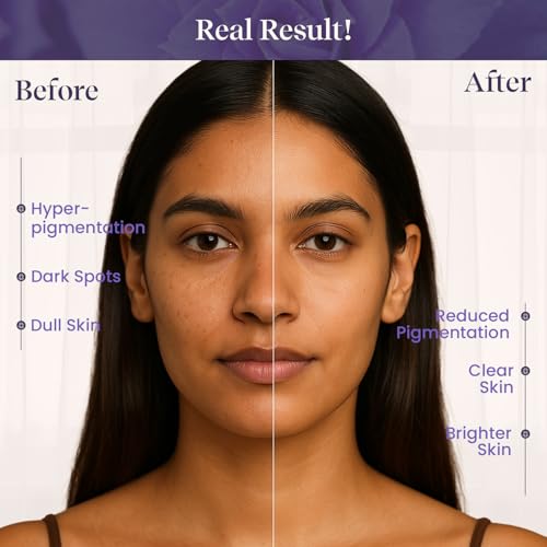Image of XYST Dark Spot Corrector Face Serum (30ml) for Women & Men | Removes Hyperpigmentation & Acne Marks | Brighten Skin with Niacinamide, Peptides, Ceramides | Derma-Tested | Suitable for All Skin Types