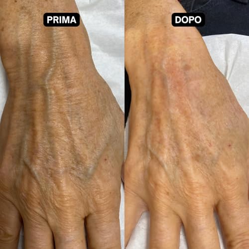 Dr. Sea - Crema Mani Nutriente Con Fango Del Mar Morto & Oli Naturali - Idratante & Protettiva - Pelle Morbida & Resistente - 100 Ml - 5