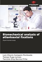 Biomechanical analysis of atlantoaxial fixations: Experimental study 620681260X Book Cover