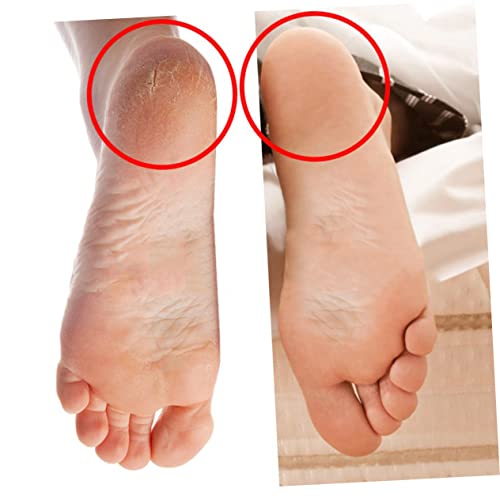 2 Pairs of SEBS Gel Anti-Crack Socks Size Color Breathable and Elastic Beach Room Socks for Dry Feet Protection3