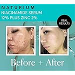 Naturium Niacinamide Face Serum 12% Plus Zinc 2%, Anti-Aging, Pore Minimizer & Dark Spot Corrector with Hyaluronic Acid & Vitamin E, Vegan & Cruelty-Free, 1 oz - Image 5
