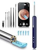 Loyker Ear Wax Removal Tool Camera, Ear Cleaner with 1080P Camera, Earwax Removal Cleaning Kit with 6 Ear Pick, Otoscope for iPhone, iPad, Android Phones, Blue