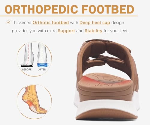 Image of ONCAI Womens Orthotic Sandals Ladies Recovery Walking Slides Arch Support Plantar Fasciitis Comfort Orthopedic Soft Cushion Summer Adjustable Sandalias Size 6-12