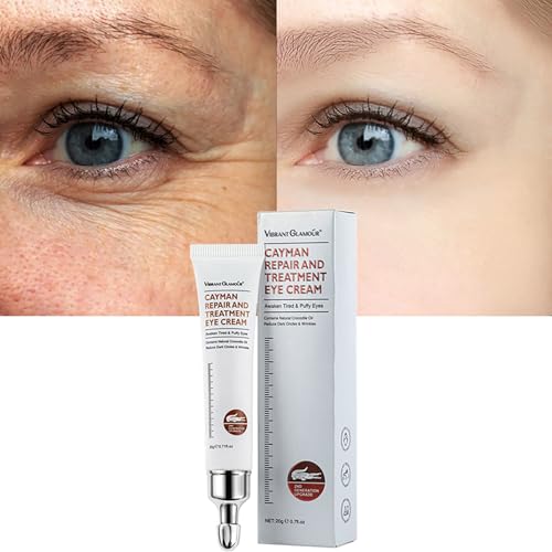 Pinnoocy Magic Eye Cream, Instantly Remove Under Eye Bags Wrinkles Puffiness Dark Circles And Fine Lines cover