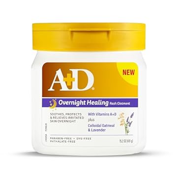 best ointment for heat rash