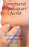  Comment Eradiquer l\'Acné: Avoir une vie plus saine (French Edition)