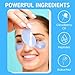 Patchology Iced Cooling Under Eye Mask Patches with Peptides, Cloudberry Oil & Bakuchiol – Firming & Soothing Eye Gels to Reduce Fine Lines and Under Eye Bags – Hydrating Under Eye Pads (5 Pairs)