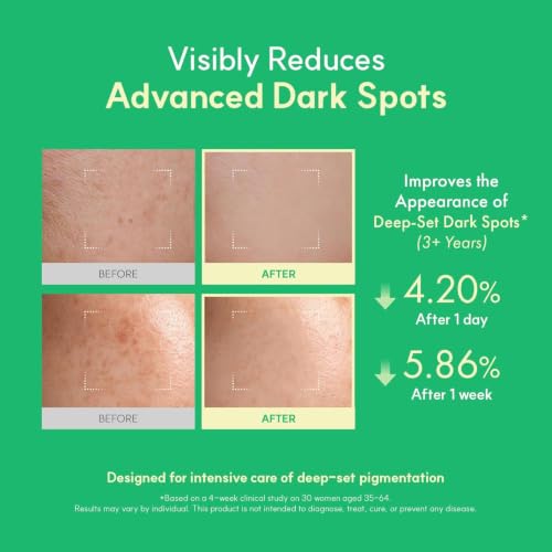 Easydew DW-EGF Melatoning Ampoule 5X - Hydrating Dark Spot Serum with Niacinamide & Glutathione for Uneven Skin - Fast Absorbing Day & Night Ampoule Korean Skin Care (Pump 0.27 fl oz, EGF 5X) - Image 4