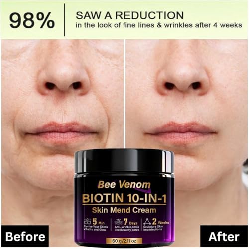 Water Ice Levin 2PCS Bee Venom Biotin 10-in-1 Skin Restoration Cream, 2026 Biotin Skin Treatment Cream, Lifting & Firming Face Cream for Wrinkle Smile Line Remover & Effectively smoothes skin and deeply Moisturizer