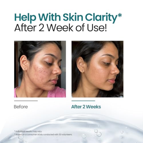 Image of La SerentiQa Alpha B3X Brightening Face Serum for Glowing Skin - 30ml | 5% Nano Niacinamide, 2% Alpha Arbutin & Vitamin C | For Dark Spots, Pigmentation & Acne Marks | Glutathione, Deep Sea Water | For Men & Women, Oily & All Skin Types