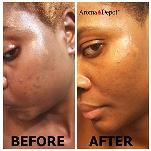 Miniatura 2 de Aroma Depot Jabón negro africano crudo de 1 libra. Jabón crudo 100% natural para acné, eczema, psoriasis, eliminación de cicatrices cara y lavado