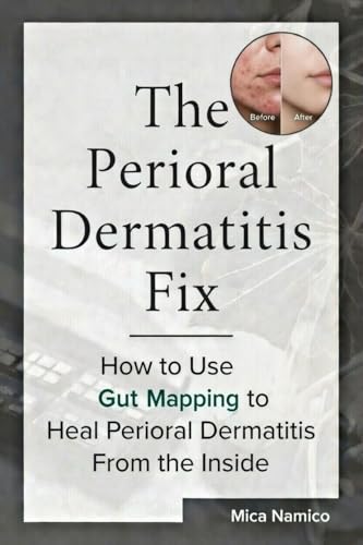 The Perioroal Dermatitis Fix: Gut Mapping to Heal Perioral Dermatitis From the Inside Out