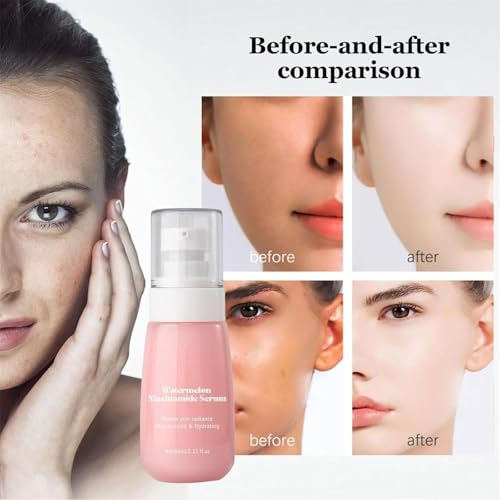 Sérum hydratant niacinamide pastèque pour un teint éclatant et repulpé