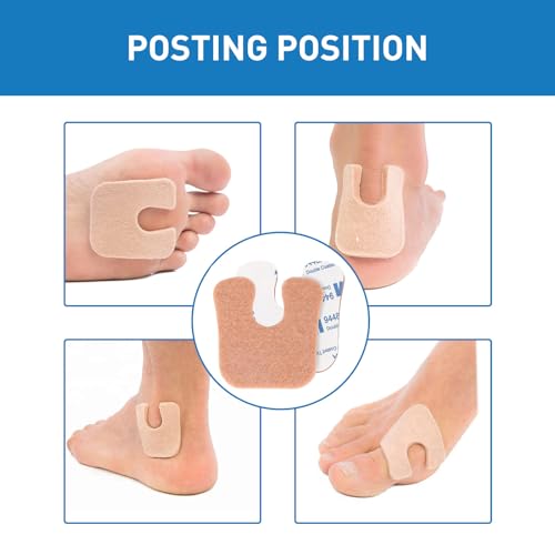Image of U-Shaped Felt Callus Pads for Feet, Soft Foot Cushions for Bottom of Foot, Toe Corn Pads Protectors for Women & Men, Reduce Foot Friction & Pain Relief